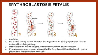 ERYTHROBLASTOSIS FETALIS
1. Rh+ father
2. Rh- mother carrying her first Rh+ fetus. Rh antigens from the developing fetus can enter the
mother’s blood during delivery.
3. In response to the fetal Rh antigens.The mother will produce anti-Rh antibodies.
4. If the woman becomes pregnant with another Rh+ fetus, her anti-Rh antibodies will cross the
placenta and damage fetal and blood cells
 