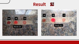 Result
A B O
A B O
Result: O+
Result: A+
 