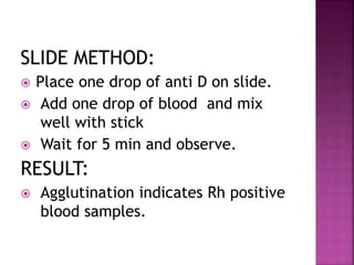 SLIDE METHOD:
 Place one drop of anti D on slide.
 Add one drop of blood and mix
well with stick
 Wait for 5 min and observe.
RESULT:
 Agglutination indicates Rh positive
blood samples.
 