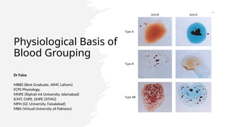 medicoseacademics@gmail.com
0310-7990649
Physiological Basis of
Blood Grouping
Dr Faiza
MBBS (Best Graduate, AIMC Lahore)
FCPS Physiology,
MHPE (Riphah Int University, Islamabad)
ICMT, CHPE, DHPE (STMU)
MPH (GC University, Faisalabad)
MBA (Virtual University of Pakistan)
 