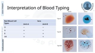 medicoseacademics@gmail.com
0310-7990649
Interpretation of Blood Typing
 