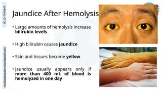 medicoseacademics@gmail.com
0310-7990649
Jaundice After Hemolysis
• Large amounts of hemolysis increase
bilirubin levels
• High bilirubin causes jaundice
• Skin and tissues become yellow
• Jaundice usually appears only if
more than 400 mL of blood is
hemolyzed in one day
 
