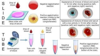 Demonstration of Blood grouping