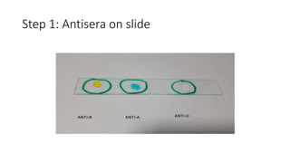 Step 1: Antisera on slide
 