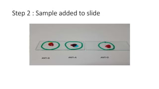Step 2 : Sample added to slide
 