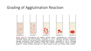 Grading of Agglutination Reaction
 