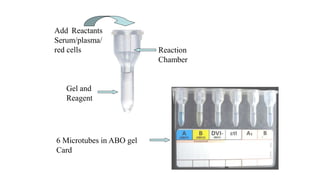 Add Reactants
Serum/plasma/
red cells Reaction
Chamber
Gel and
Reagent
6 Microtubes in ABO gel
Card
 