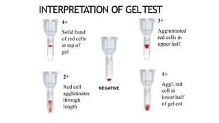 INTERPRETATION OF GELTEST
4+
Solid band
of red cells
at top of
gel
3+
Agglutinated
red cells in
upper half
2+
Red cell
agglutinates
through
length
1+
Aggl. red
cell in
lower half
of gel col.
NEGATIVE
 
