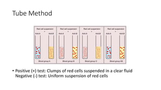 Tube Method
• Positive (+) test: Clumps of red cells suspended in a clear fluid
Negative (-) test: Uniform suspension of red cells
 