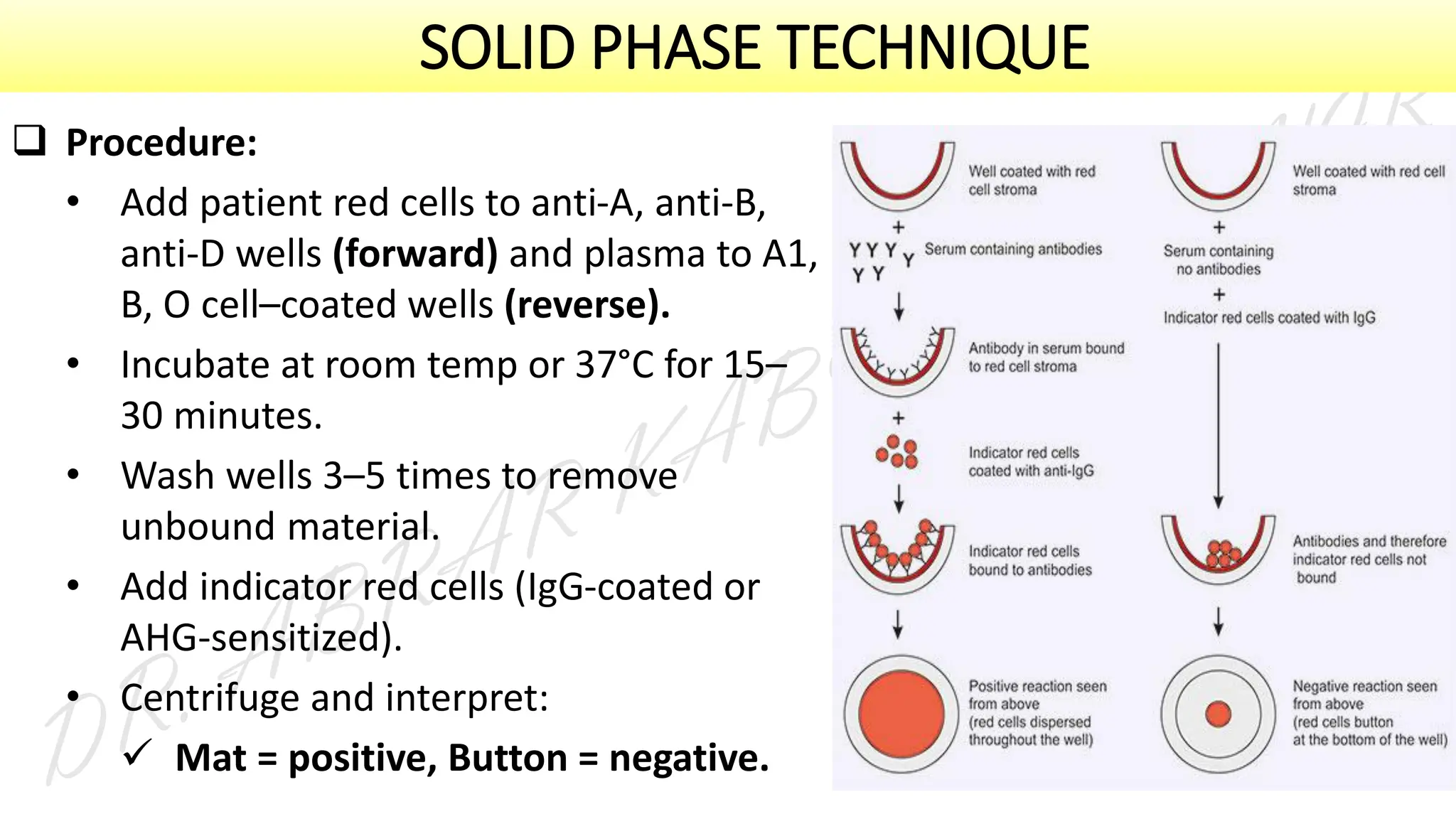 SOLID PHASE TECHNIQUE
❑ Procedure:
• Add patient red cells to anti-A, anti-B,
anti-D wells (forward) and plasma to A1,
B, O cell–coated wells (reverse).
• Incubate at room temp or 37°C for 15–
30 minutes.
• Wash wells 3–5 times to remove
unbound material.
• Add indicator red cells (IgG-coated or
AHG-sensitized).
• Centrifuge and interpret:
✓ Mat = positive, Button = negative.
 