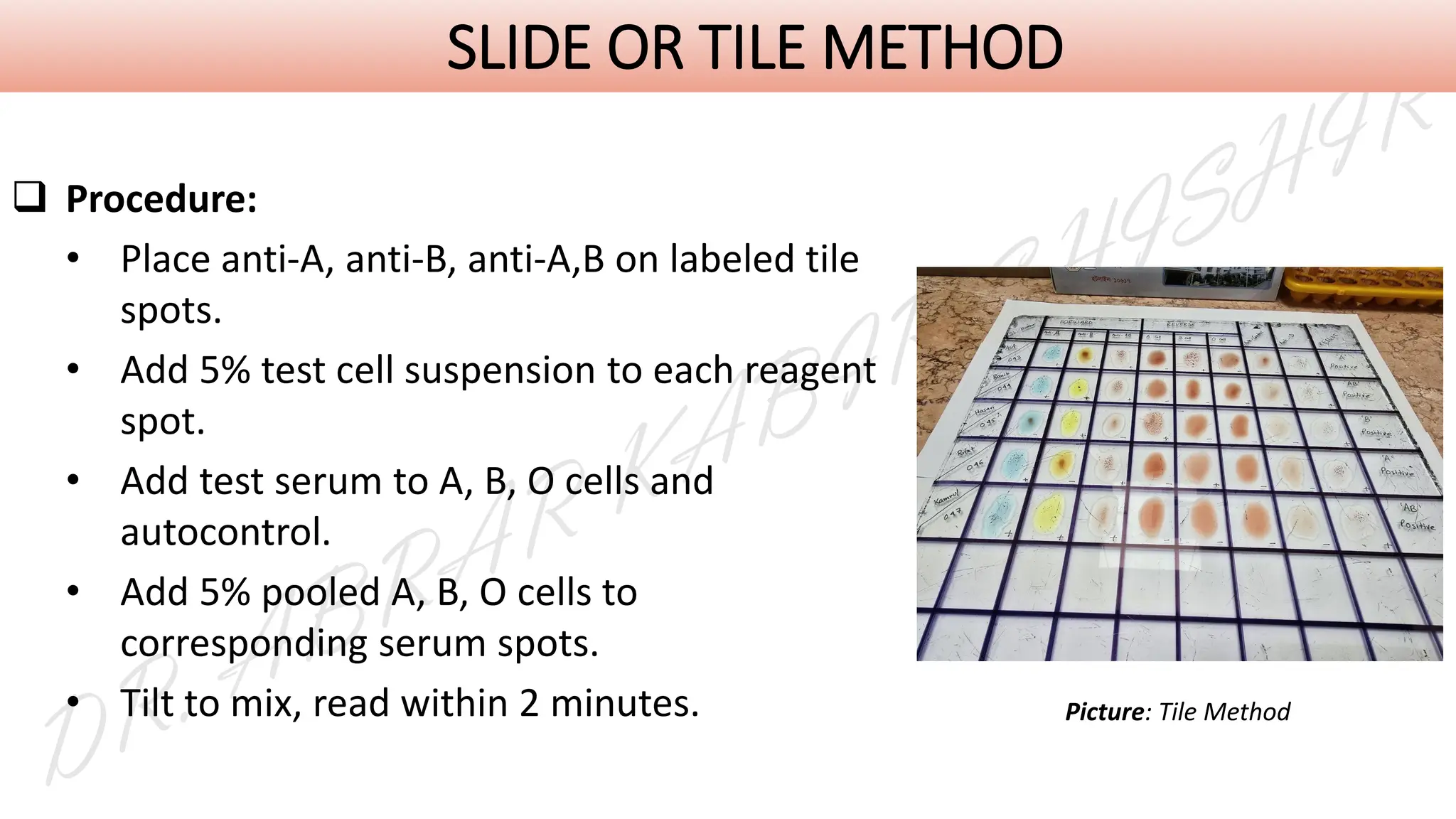 ❑ Procedure:
• Place anti-A, anti-B, anti-A,B on labeled tile
spots.
• Add 5% test cell suspension to each reagent
spot.
• Add test serum to A, B, O cells and
autocontrol.
• Add 5% pooled A, B, O cells to
corresponding serum spots.
• Tilt to mix, read within 2 minutes.
SLIDE OR TILE METHOD
Picture: Tile Method
 