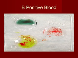 Blood groups and typing | PPT