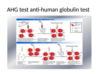 Blood group system-1...........................pptx