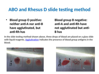 Blood group system-1...........................pptx
