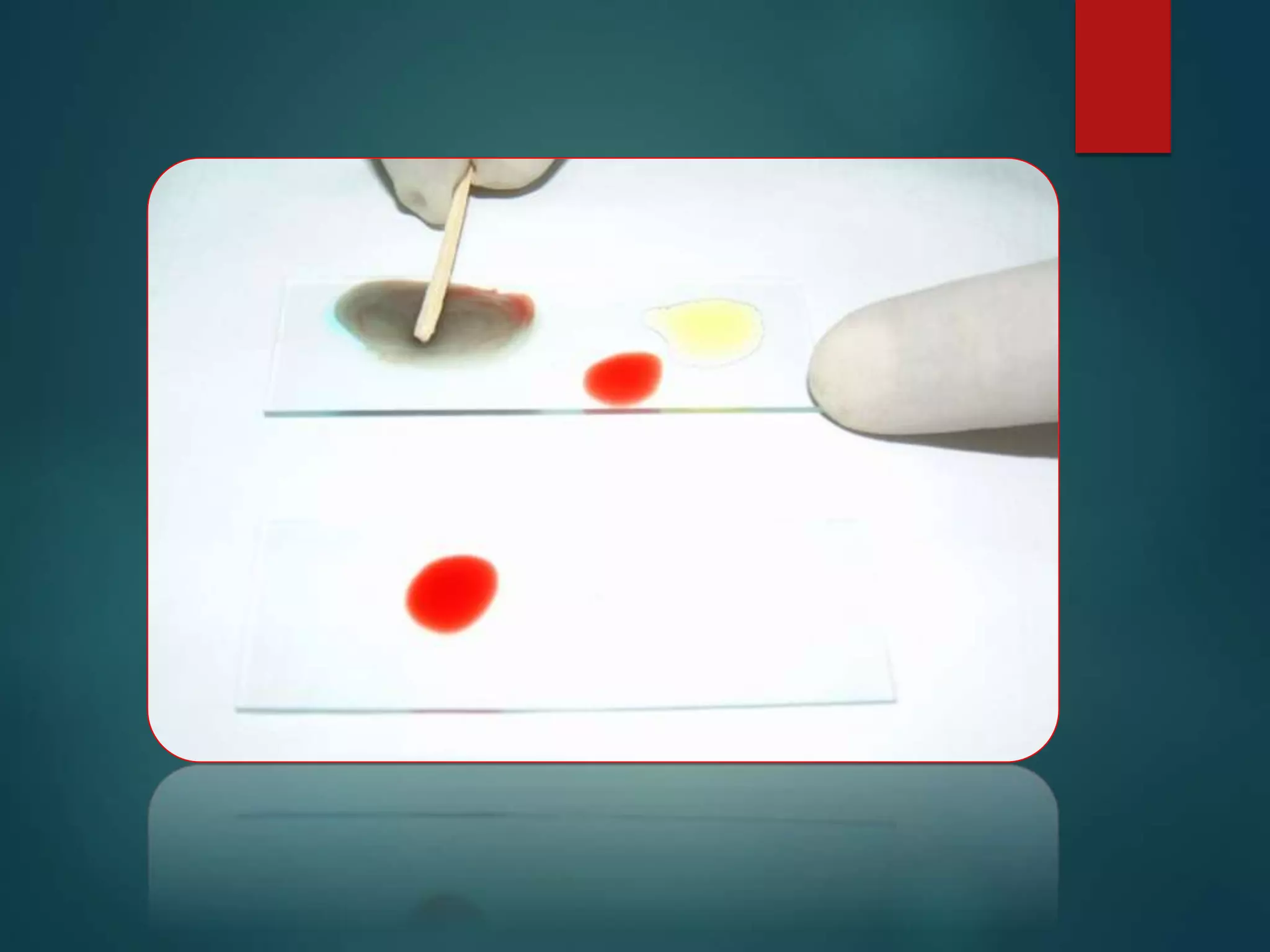 Blood Group Systems_ABO & Rh.ppt