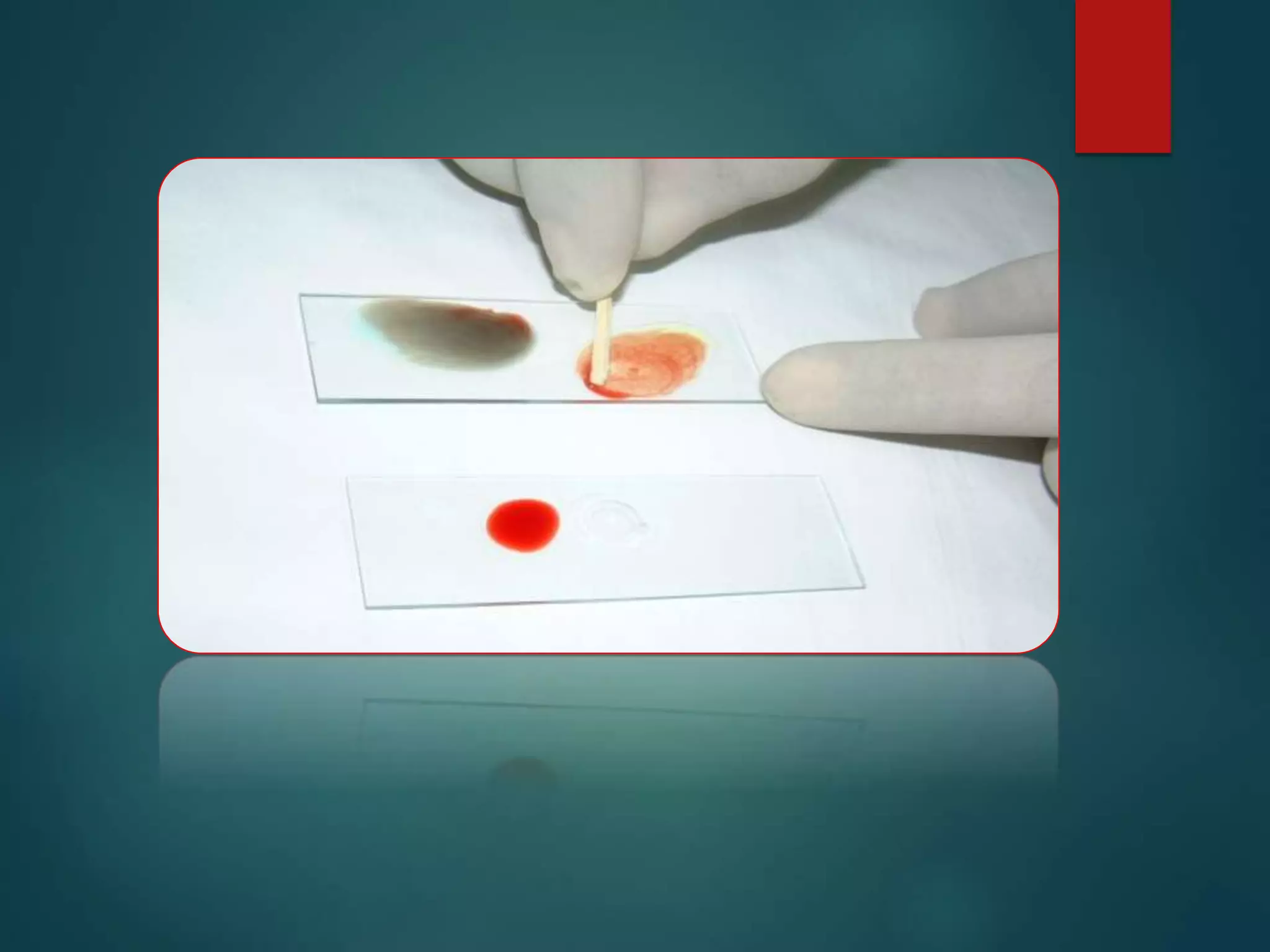 Blood Group Systems_ABO & Rh.ppt