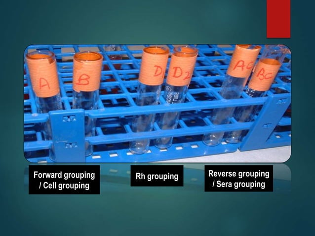 Blood Group Systems_ABO & Rh.ppt | Blood Disorders | Diseases and ...