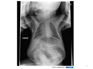 17
Source undetermined
 