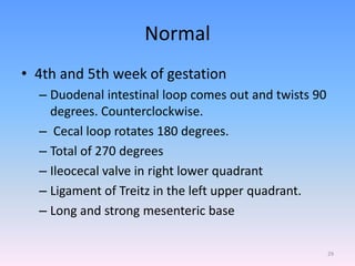 Normal
• 4th and 5th week of gestation
– Duodenal intestinal loop comes out and twists 90
degrees. Counterclockwise.
– Cecal loop rotates 180 degrees.
– Total of 270 degrees
– Ileocecal valve in right lower quadrant
– Ligament of Treitz in the left upper quadrant.
– Long and strong mesenteric base
29
 