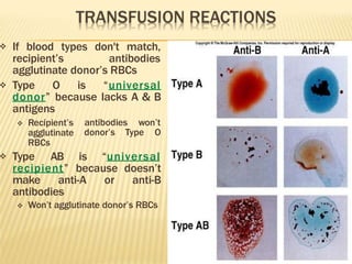  If blood types don't match,
recipient’s antibodies
agglutinate donor’s RBCs
 Type O is “universal
donor” because lacks A & B
antigens
antibodies won’t
donor’s Type O
 Recipient’s
agglutinate
RBCs
 Type AB is “universal
recipient” because doesn’t
make anti-A or anti-B
antibodies
 Won’t agglutinate donor’s RBCs
🞭 Insert fig. 13.6
 