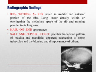 Radiographic findings
• RIB- WITHIN- A- RIB: noted in middle and anterior
portion of the ribs. Long linear density within or
overlapping the medullary space of the rib and running
parallel to its long axis.
• HAIR- ON- END appearance.
• SALT AND PEPPER EFFECT: peculiar trabeculae pattern
of maxilla and mandible, apparent coarsening of some
trabeculae and the blurring and disappearance of others.
 