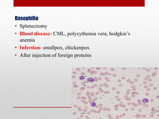 Basophilia
• Splenectomy
• Blood disease- CML, polycythemia vera, hodgkin’s
anemia
• Infection- smallpox, chickenpox
• After injection of foreign proteins
 