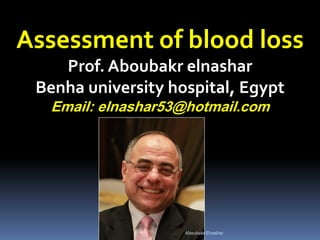 Assessment of blood loss
Prof. Aboubakr elnashar
Benha university hospital, Egypt
Email: elnashar53@hotmail.com
Aboubakr Elnashar
 