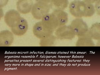 Babesia microti infection, Giemsa stained thin smear. The
organisms resemble P. falciparum; however Babesia
parasites present several distinguishing features: they
vary more in shape and in size; and they do not produce
pigment.
 