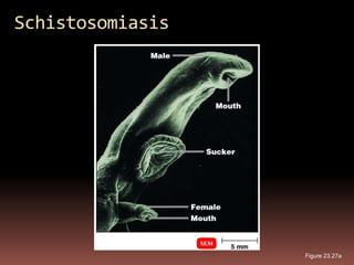 Schistosomiasis




                  Figure 23.27a
 