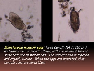Schistosoma mansoni eggs: large (length 114 to 180 µm)
and have a characteristic shape, with a prominent lateral
spine near the posterior end. The anterior end is tapered
and slightly curved. When the eggs are excreted, they
contain a mature miracidium
 