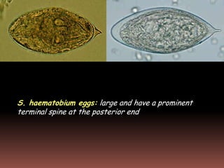 S. haematobium eggs: large and have a prominent
terminal spine at the posterior end
 