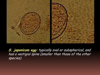 S. japonicum egg: typically oval or subspherical, and
has a vestigial spine (smaller than those of the other
species)
 