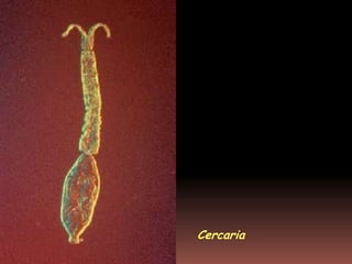 Cercaria
 