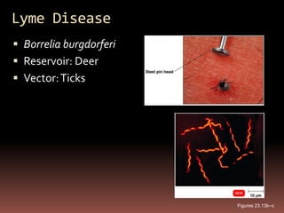 Lyme Disease
 Borrelia burgdorferi
 Reservoir: Deer
 Vector: Ticks




                         Figures 23.13b–c
 