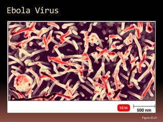 Ebola Virus




              Figure 23.21
 