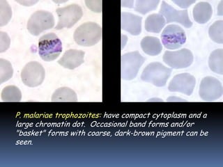 P. malariae trophozoites: have compact cytoplasm and a
large chromatin dot. Occasional band forms and/or
"basket" forms with coarse, dark-brown pigment can be
seen.
 
