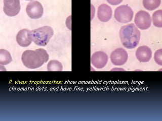 P. vivax trophozoites: show amoeboid cytoplasm, large
chromatin dots, and have fine, yellowish-brown pigment.
 