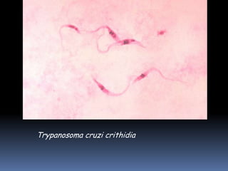 Trypanosoma cruzi crithidia
 