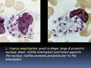 L. tropica amastigotes: ovoid in shape; large & eccentric
nucleus; small, rodlike kinetoplast positioned opposite
the nucleus; rodlike axoneme perpendicular to the
kinetoplast
 