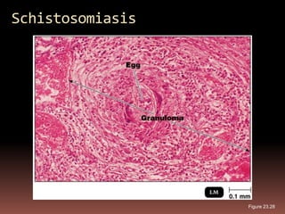 Schistosomiasis




                  Figure 23.28
 