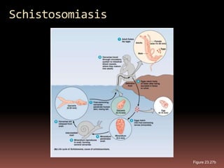 Schistosomiasis




                  Figure 23.27b
 