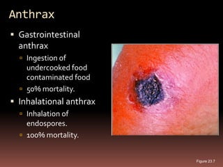 Anthrax
 Gastrointestinal
  anthrax
   Ingestion of
    undercooked food
    contaminated food
   50% mortality.
 Inhalational anthrax
   Inhalation of
    endospores.
   100% mortality.


                         Figure 23.7
 