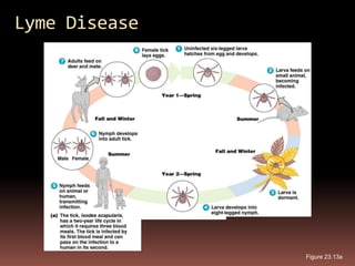 Lyme Disease




               Figure 23.13a
 
