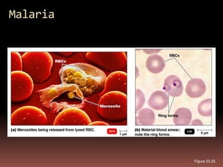 Malaria




          Figure 23.25
 