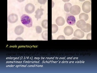P. ovale gametocytes: round to oval, and may almost fill
the red blood cells (RBCs). Pigment is brown and more
coarse than that of P. vivax. RBCs are normal to slightly
enlarged (1 1/4 ×), may be round to oval, and are
sometimes fimbriated. Schüffner's dots are visible
under optimal conditions.
 