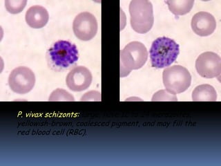 P. vivax schizonts: large, have 12 to 24 merozoites,
yellowish-brown, coalesced pigment, and may fill the
red blood cell (RBC).
 