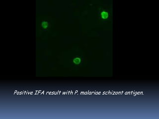 Positive IFA result with P. malariae schizont antigen.
 