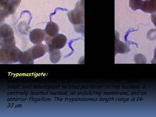 Trypomastigote: slender to fat and stumpy forms; in
Giemsa stained films – C or U shaped forms NOT seen;
small, oval kinetoplast located posterior to the nucleus; a
centrally located nucleus, an undulating membrane, and an
anterior flagellum. The trypanosomes length range is 14-
33 µm
 