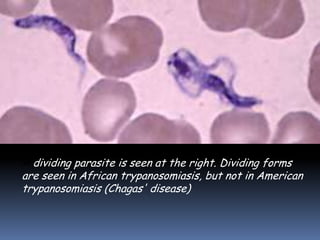 A dividing parasite is seen at the right. Dividing forms
are seen in African trypanosomiasis, but not in American
trypanosomiasis (Chagas' disease)
 