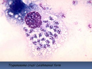 Trypanosoma cruzi: Leishmanial form
 